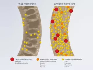 AN69_membrane_vs_PAES_membrane