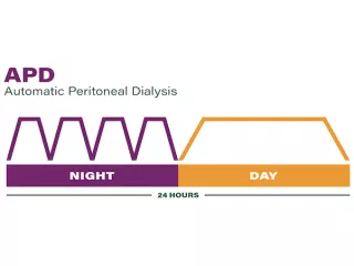 APD Graph