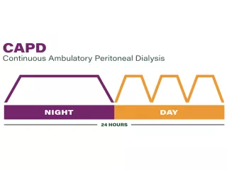CAPD Graph