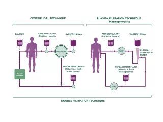 Graph of how TPE works